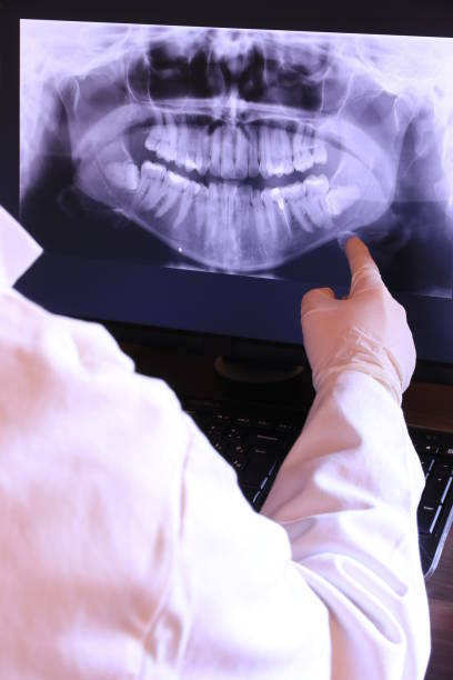 Best Emergency Treatment for Oral Infections in French Valley, CA